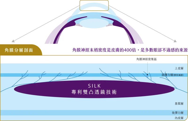 SILK Double Convex Lens Design